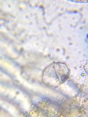 Parvodinium inconspicuum