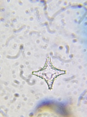 Staurastrum cerastes