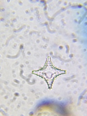 Staurastrum cerastes