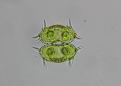 Xanthidium antilopaeum polymazum