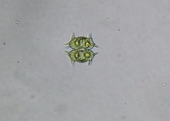 Xanthidium antilopaeum polymazum