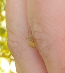 Clubionidae