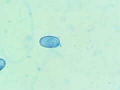 Scutellinia olivascens