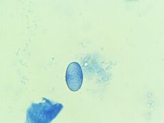 Scutellinia olivascens