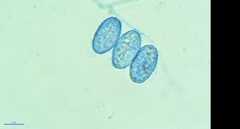 Scutellinia olivascens