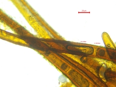 Scutellinia olivascens