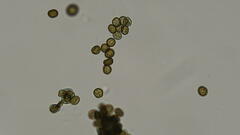 Ustilago syntherismae