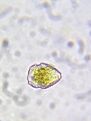 Parvodinium inconspicuum