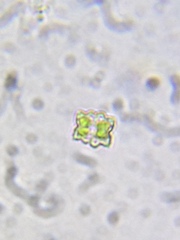 Euastrum denticulatum