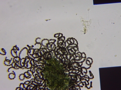 Dolichospermum lemmermannii