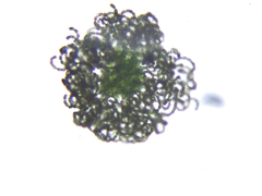 Dolichospermum lemmermannii