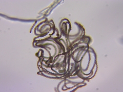 Dolichospermum