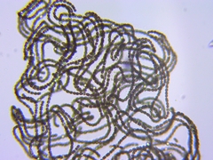 Dolichospermum