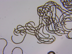 Dolichospermum
