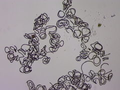 Dolichospermum