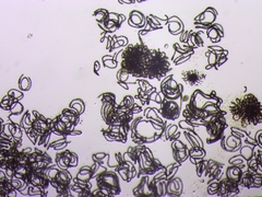 Dolichospermum