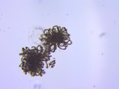 Dolichospermum