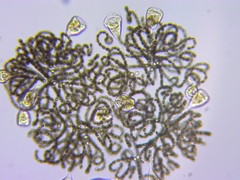 Dolichospermum