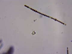 Dolichospermum