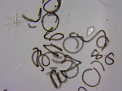 Dolichospermum
