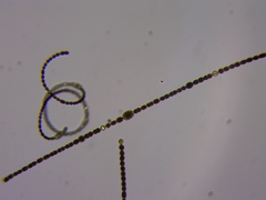 Dolichospermum