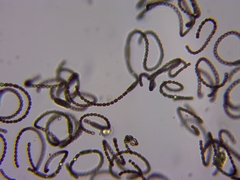 Dolichospermum