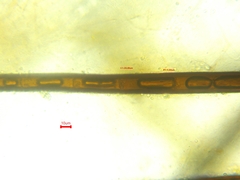 Scutellinia colensoi