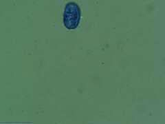 Scutellinia colensoi