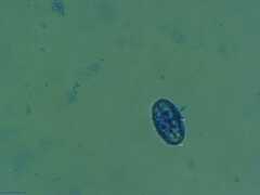 Scutellinia colensoi