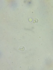 Clavulinopsis appalachiensis