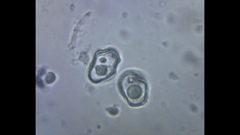 Cyanula