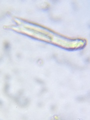 Chaetonotidae