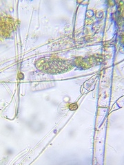 Hymenostomatia