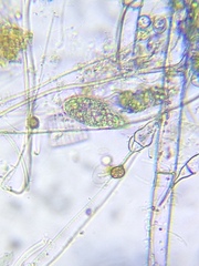 Hymenostomatia