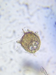 Centropyxis aculeata