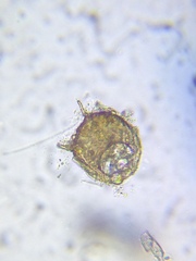 Centropyxis aculeata