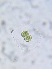 Cosmarium contractum