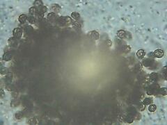 Microcystis