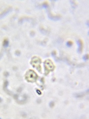 Phalansterium consociatum