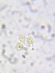 Phalansterium consociatum