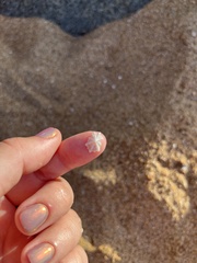 Hemitoma octoradiata