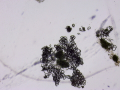 Dolichospermum lemmermannii