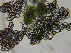 Dolichospermum lemmermannii