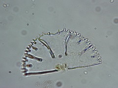 Micrasterias conferta