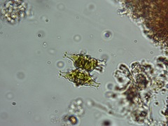 Staurastrum distentum