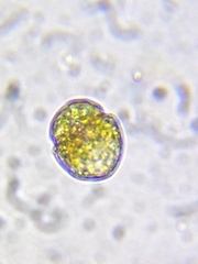 Parvodinium inconspicuum