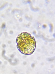 Parvodinium inconspicuum