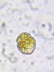 Parvodinium inconspicuum