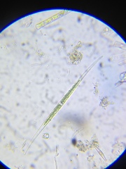 Closterium acutum