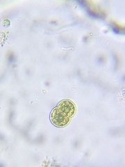 Cosmarium punctulatum